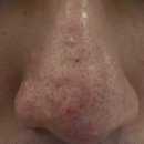 진성레이져 이미지