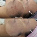 도봉-쌍문-도봉-1123 | 나이가 들수록 탄력을 잃더니 건조함에 주름까지... 방법이 없을까요?
