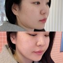 (주)끌리메 | 신사역 에스테틱 끌리메 작은얼굴 윤곽관리 솔직후기