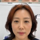 능안로1 | [공지] 파주 눈썹문신추천 (중년 고객님 콤보눈썹 후기) 자연스러움과 또렷함을 동시에