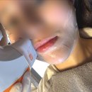 워너비호텔 | 대전 신세계 피부과 아이워너비 (이마필러, 슈링크 유니버스) 내돈내산 찐후기!