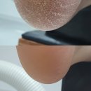 멋진발관리 이미지