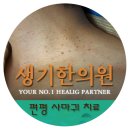 평사 이미지