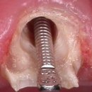 동은치과기공소 이미지