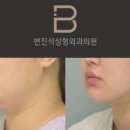 변진석성형외과의원 이미지