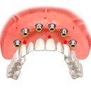 한결치과 이미지