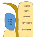 금물산하늘소캠프 이미지