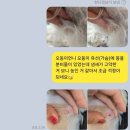 트레밍MM 이미지