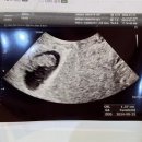 자연그린한방병원 | 인천 서구 그린산부인과 자연분만 출산 후기