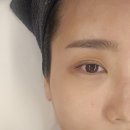 [순천] 순천 피부관리 끝판왕 광채 효과 대박 마이크로젯 도,윤결 순천 본점🤗