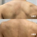 보습 바디미스트 추천 낫포유 바디미스트 등드름 없애는법 후기