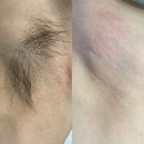 아나덴 슈가링왁싱 수원인계점 이미지