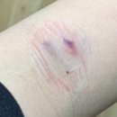 산전 | 임신전 산전검사 병원방문 후기!