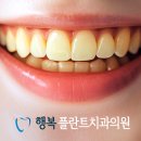 미백세탁소 이미지