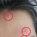 국홍일국정표피부과의원 이미지