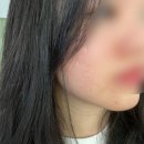 일산 피부관리 리페어관리 후기 에셀스킨