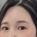 벨포인트의원 네이버블로그