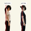 요가집요가&필라테스 | [공지] 거창 필라테스 ,척추측만과 어깨비대칭 체형교정 후기