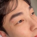페리투에스테틱 이미지