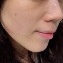 백설공주피부관리실 | 면목동 피부관리 바나나부띠끄 백설공주케어 글루타티온 관리 후기