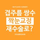 눈 비대칭, 겹주름 쌍수 재수술 만으로 대칭 맞출 수 있을까요 이미지