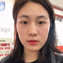 신창치과의원 | [2020.01.16] 매복 사랑니 발치 후기