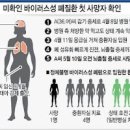 기침이오래가요 만성기침이라면 폐섬유화증상 의심 이미지