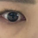 좋은이안과의원 이미지