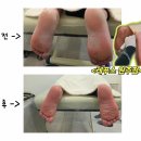 AK플라자 원주점(지하3층) | 원주 발각질 원주내성발톱<레푸스 원주점> 발 관리 제대로 받은 후기