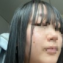 다이소 셀프 매직약 후기 셀프 모류교정 방법