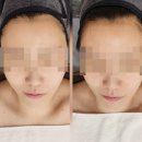 올가드림뷰티 부안점 | 부안 모공 디톡스 관리 추천! 올가드림뷰티 솔직후기~ 피부 톤과 리프팅 동시에 잡았어요