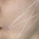 팔자주름 실리프팅 후기 변화 체감 스토리