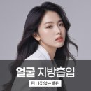멍메이드 | 얼굴지방흡입 후기, 멍 없던 이유 이거였네