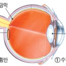 안과 ~~ 황반변성 ~~~ 중심성 장액맥락 망막증 이미지