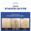 해결한의원 네이버블로그