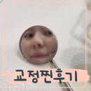 강서하늘치과의원 | 강서구 교정치과 화곡역 치아교정 충치까지 하고온 후기