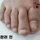 레푸스 사상점 이미지
