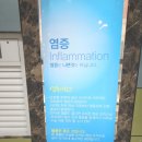 대구허리디스크병원 참지마세요!