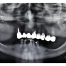 더엠디 치주과 치과의원 이미지