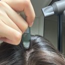 두나몰 | 민트리 스칼프 세럼 두피 탈모 고민 내 돈으로 구매 리얼 사용기