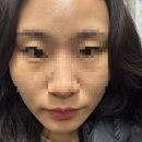 B10-2 | 대구모공관리_비텐에스테틱(B10) 모공완전청소 관리 후기(주차, 가격, 후기 등)