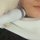 서면 롯데호텔 옆 | 부산 서면 피부과 방문후기 :: 부산롯데호텔 피부과 온다 5만줄 리프팅 후기