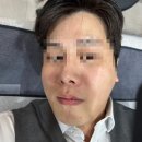 안산 신부관리 피부과 추천 뮤즈의원 안산점 내돈내산 솔직 후기
