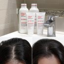 샴푸헤어 | 탈모샴푸순위 1위 닥터포헤어 폴리젠 샴푸 솔직후기