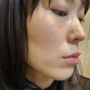 김해 | 부산 리쥬란 손주사가 최고인 이유?! 김해 피부과 후기