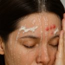 수헤어라인 이미지