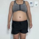 자인필라테스 | 다이어트 다 해봤는데 결국 이거였다 부산 복부지방흡입 + 골반지방이식 리얼 후기
