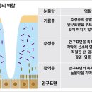 눈물막 불안정·높은 삼투압 등이 건성안 원인 노인성 안구 건조증(Ophthalmoxerosis) ＜ 이미지