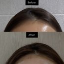 ㈜제일에너지 | 두피홈케어, 두피볼륨 살리는 다비네스샴푸 에너자이징 라인, 진짜 효과는?