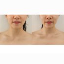 더 올림(The Ollim) | [마곡] 마곡 피부관리 작은 얼굴 더 올림 에스테틱 내돈내산 후기!